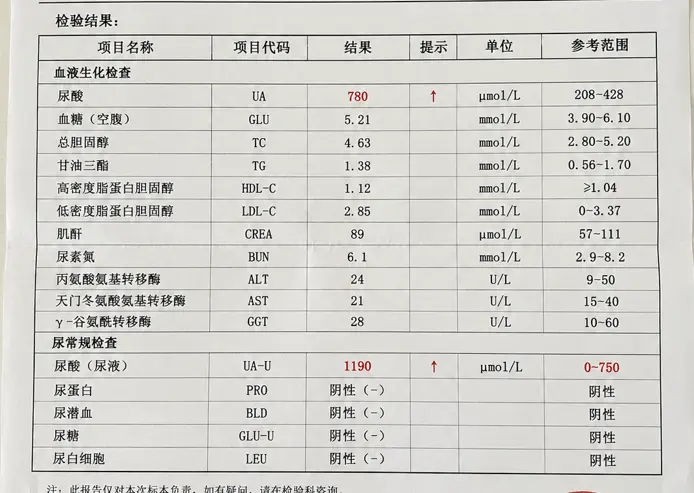 啤酒小王子今天陨落