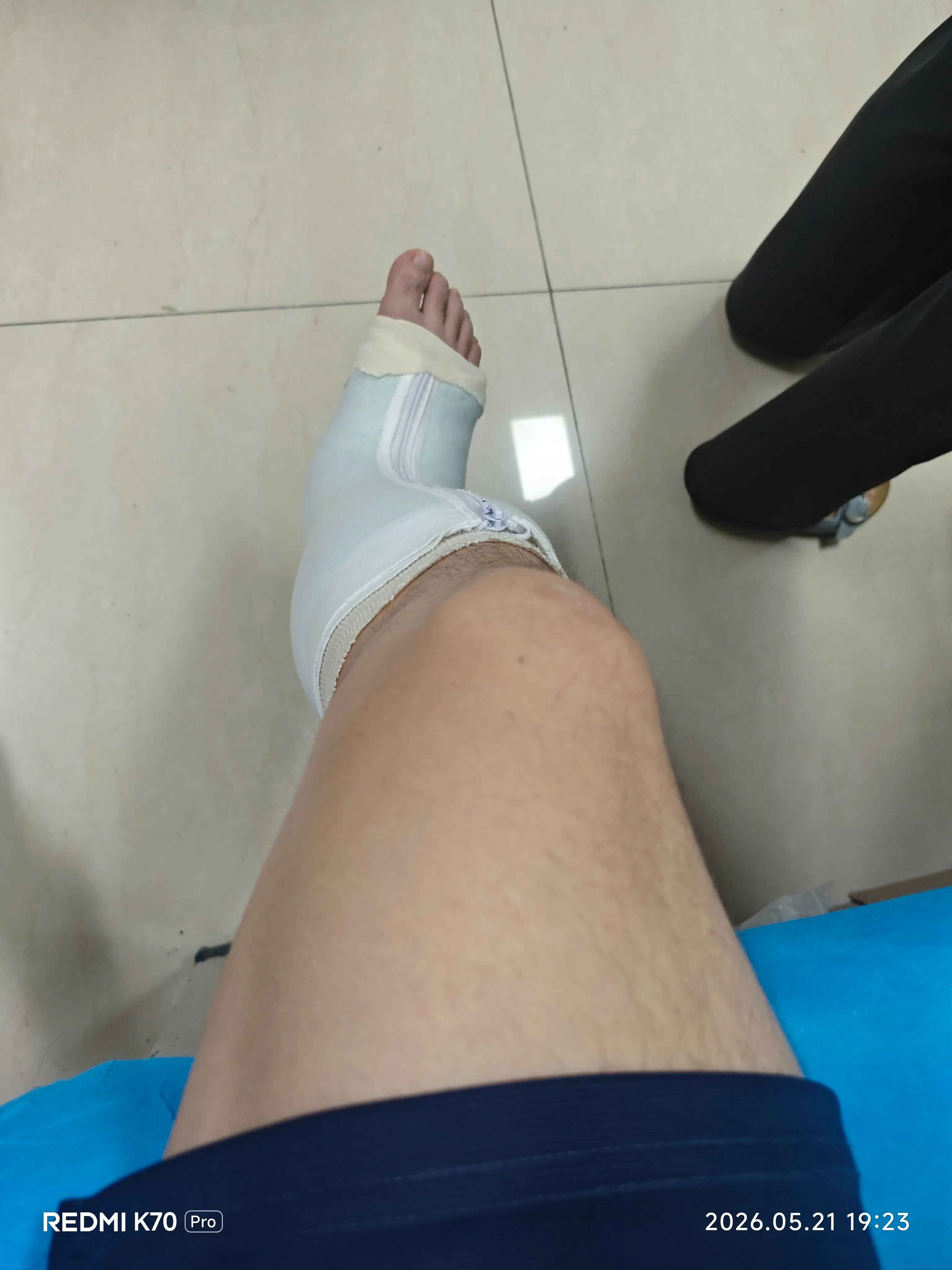 打球摔骨折啦 nilv.cn 骨折出  128R